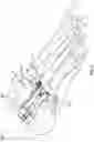 Fig. 20 - Modular bone implant devices and means of insertion