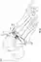 Fig. 26 - Modular bone implant devices and means of insertion