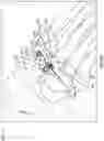 Fig. 27 - Modular bone implant devices and means of insertion