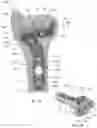 Fig. 02 - Distal radius stabilization system