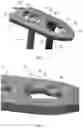 Fig. 06 - Distal radius stabilization system