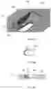 Fig. 09 - Distal radius stabilization system