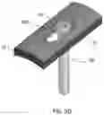 Fig. 13 - Distal radius stabilization system