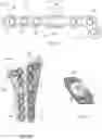 Fig. 25 - Distal radius stabilization system