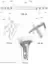 Fig. 27 - Distal radius stabilization system
