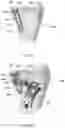Fig. 28 - Distal radius stabilization system