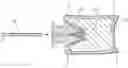 Fig. 01 - SYSTEMS, METHODS, AND APPARATUS FOR SPINAL DEFORMITY CORRECTION