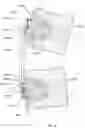 Fig. 10 - SYSTEMS, METHODS, AND APPARATUS FOR SPINAL DEFORMITY CORRECTION