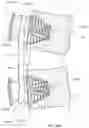 Fig. 13 - SYSTEMS, METHODS, AND APPARATUS FOR SPINAL DEFORMITY CORRECTION