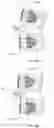 Fig. 27 - SYSTEMS, METHODS, AND APPARATUS FOR SPINAL DEFORMITY CORRECTION