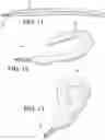 Fig. 11 - Endovascular near critical fluid based cryoablation catheter and related methods