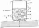 Fig. 01 - Estimation of tissue thickness