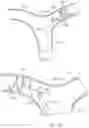 Fig. 16 - CATHETER APPARATUSES FOR MODULATION OF NERVES IN COMMUNICATION WITH THE PULMONARY SYSTEM AND ASSOCIATED SYSTEMS AND METHODS