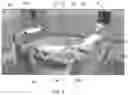 Fig. 03 - Methods for robotic assistance and navigation in spinal surgery and related systems