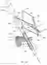 Fig. 18 - Methods for robotic assistance and navigation in spinal surgery and related systems