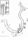 Fig. 12 - DEVICES SYSTEMS AND METHODS FOR CORONARY INTERVENTION ASSESSMENT, PLANNING, AND TREATMENT BASED ON DESIRED OUTCOME