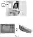 Fig. 05 - Method of registering an imaging scan with a coordinate system and associated systems