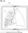 Fig. 10 - Systems and methods for using tracking in image-guided medical procedure