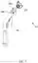 Fig. 09 - Surgical device with movement compensation