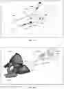 Fig. 14 - Augmented Reality Assisted Surgical Workflow Navigation