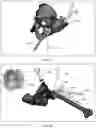 Fig. 17 - Augmented Reality Assisted Surgical Workflow Navigation
