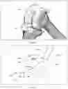Fig. 27 - Augmented Reality Assisted Surgical Workflow Navigation