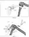 Fig. 28 - Augmented Reality Assisted Surgical Workflow Navigation