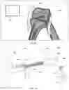 Fig. 29 - Augmented Reality Assisted Surgical Workflow Navigation