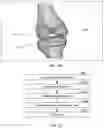 Fig. 37 - Augmented Reality Assisted Surgical Workflow Navigation