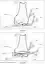 Fig. 42 - Augmented Reality Assisted Surgical Workflow Navigation
