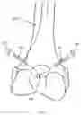 Fig. 05 - SURGICAL ASSISTIVE ROBOT ARM