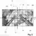 Fig. 04 - SURGERY ASSISTANCE SYSTEM AND METHOD FOR GENERATING CONTROL SIGNALS FOR VOICE CONTROL OF MOTOR-CONTROLLED MOVABLE ROBOT KINEMATICS OF SUCH A SURGERY ASSISTANCE SYSTEM
