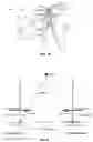 Fig. 04 - Robotic surgical methods and apparatuses