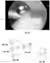 Fig. 06 - Robotic surgical methods and apparatuses