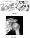 Fig. 09 - Robotic surgical methods and apparatuses