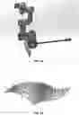 Fig. 10 - Robotic surgical methods and apparatuses