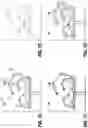 Fig. 08 - ROBOTIC SURGICAL COLLISION DETECTION SYSTEMS