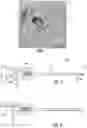 Fig. 02 - BIOPSY DEVICE MARKER AND RELATED METHODS