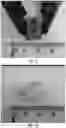 Fig. 06 - BIOPSY DEVICE MARKER AND RELATED METHODS