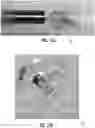 Fig. 08 - BIOPSY DEVICE MARKER AND RELATED METHODS