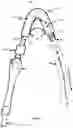 Fig. 04 - CONNECTION ADAPTOR FOR USE WITH DENTAL TOOLS