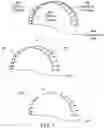 Fig. 04 - ALIGNER STAGE ANALYSIS TO OBTAIN MECHANICAL INTERACTIONS OF ALIGNERS AND TEETH FOR TREATMENT PLANNING
