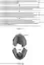 Fig. 02 - DETERMINATION OF AT LEAST ONE SUITABLE REMOVABLE ORTHODONTIC APPLIANCE