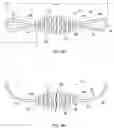 Fig. 08 - SYSTEMS AND METHODS FOR PROVIDING AN ORTHODONTIC SPRING