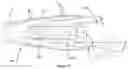Fig. 15 - A DENTAL IMPLANT ASSEMBLY