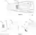 Fig. 17 - A DENTAL IMPLANT ASSEMBLY