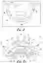 Fig. 03 - Fixation base and guides for dental prosthesis installation