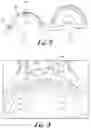 Fig. 05 - Fixation base and guides for dental prosthesis installation