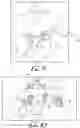 Fig. 06 - Fixation base and guides for dental prosthesis installation