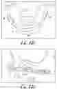 Fig. 08 - Fixation base and guides for dental prosthesis installation